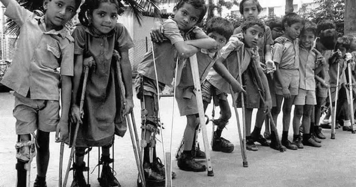 پولیو ویروس په اړه مهم حقیقتونه