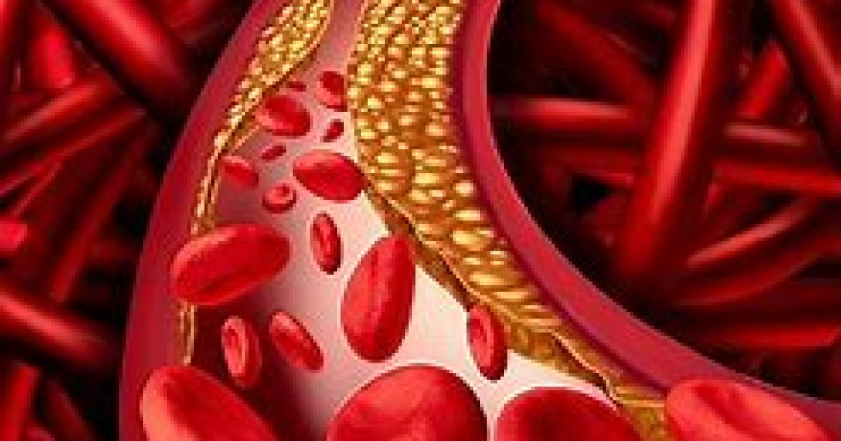 کولیسټرول Cholestrole