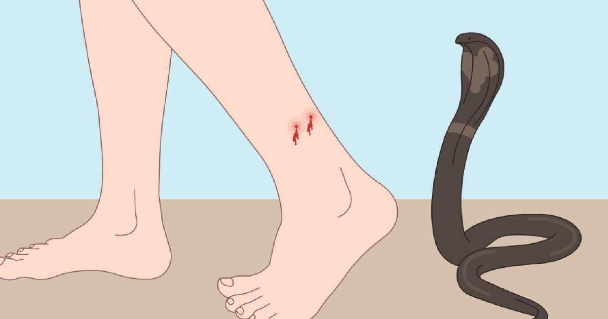 مار چیچل بیړنی حالت