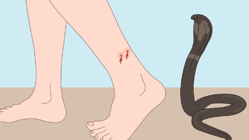 مار چیچل بیړنی حالت