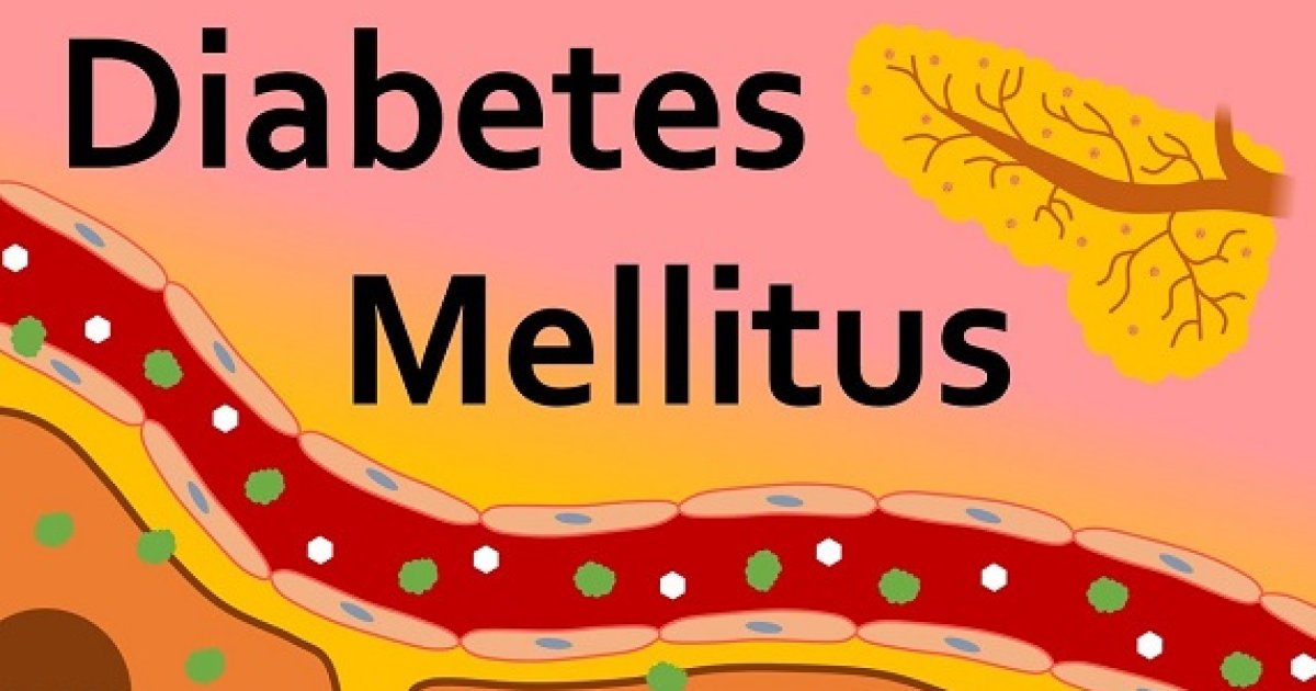 خوږه شکره (Diabetes Mellitus)