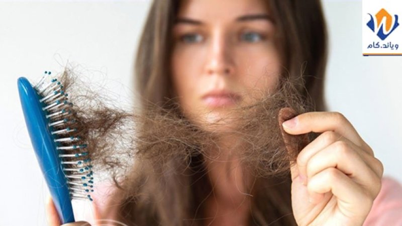 د وېښتانو تویدلو ۶  اصلي لاملونه؟