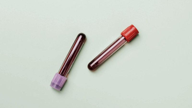 که له وینې څخه وېرېږئ، دا رواني ناروغي لرئ!