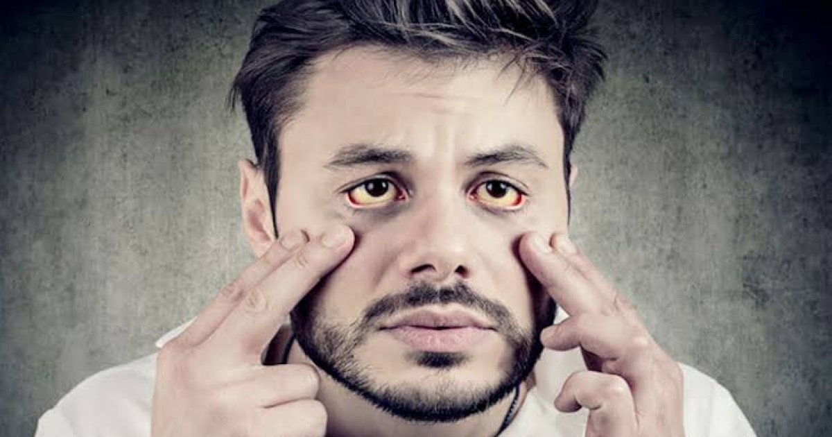 زېړی څنګه منځته راځي؟