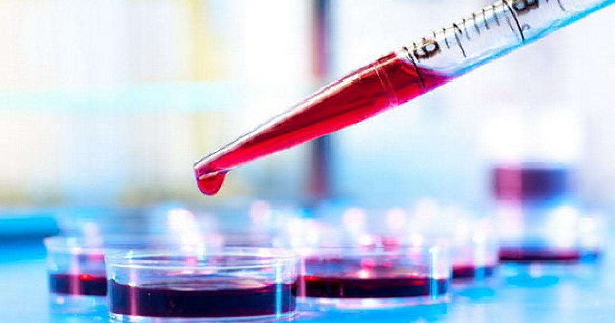 د انیمیا (د وینې د کمښت) مخنیوی