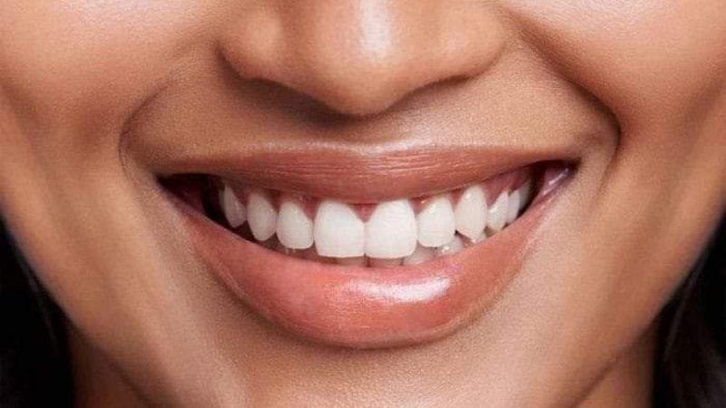 د خندا او موسکا ګټې