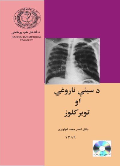 د سینې ناروغي او توبر کلوز