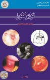 توبرکلوز cover image