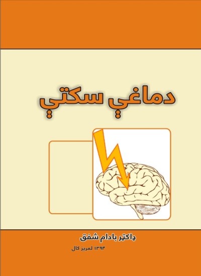 دماغي سکتې