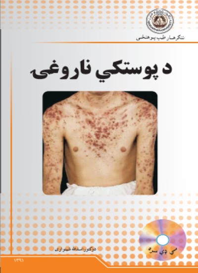 د پوستکي ناروغی