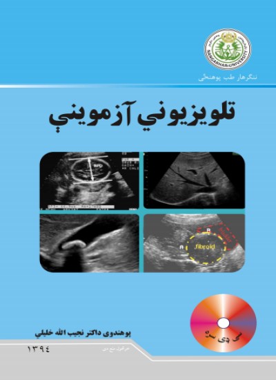 تلویزیوني آزموینې