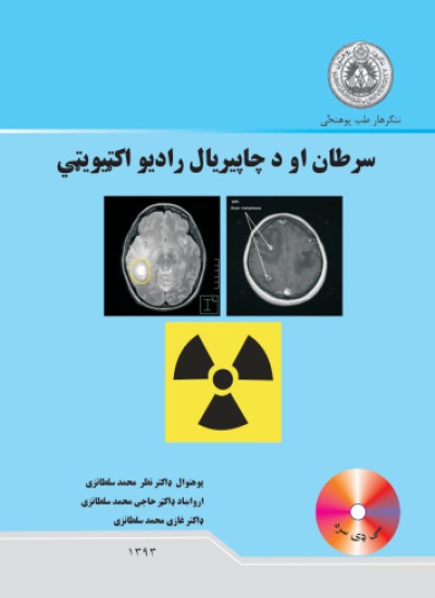 د زړه برقي ګراف