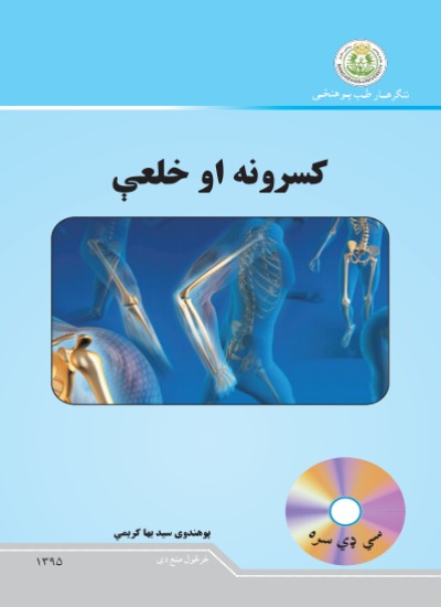 کسرونه او خلعې