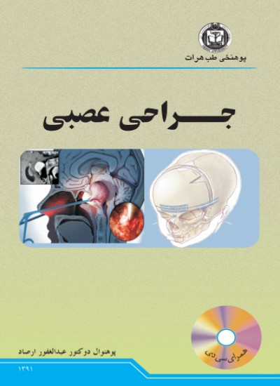 جراحی عصبی