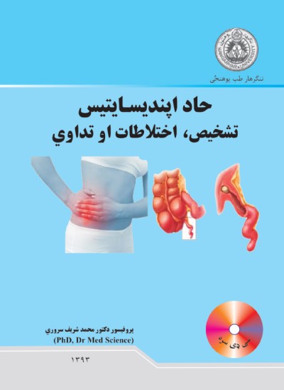 حاد اپندیسایتیس تشخیص، اختلاطات او تداوې
