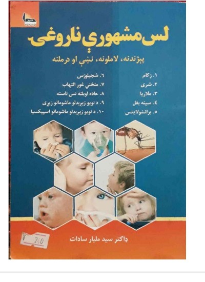 لس مشهوری ناروغی